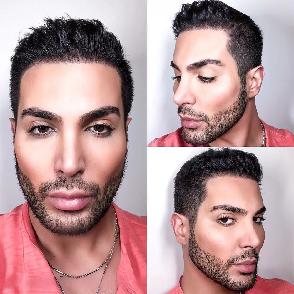 عکس نتایج بعد از کاشت ابرو مرد جوان