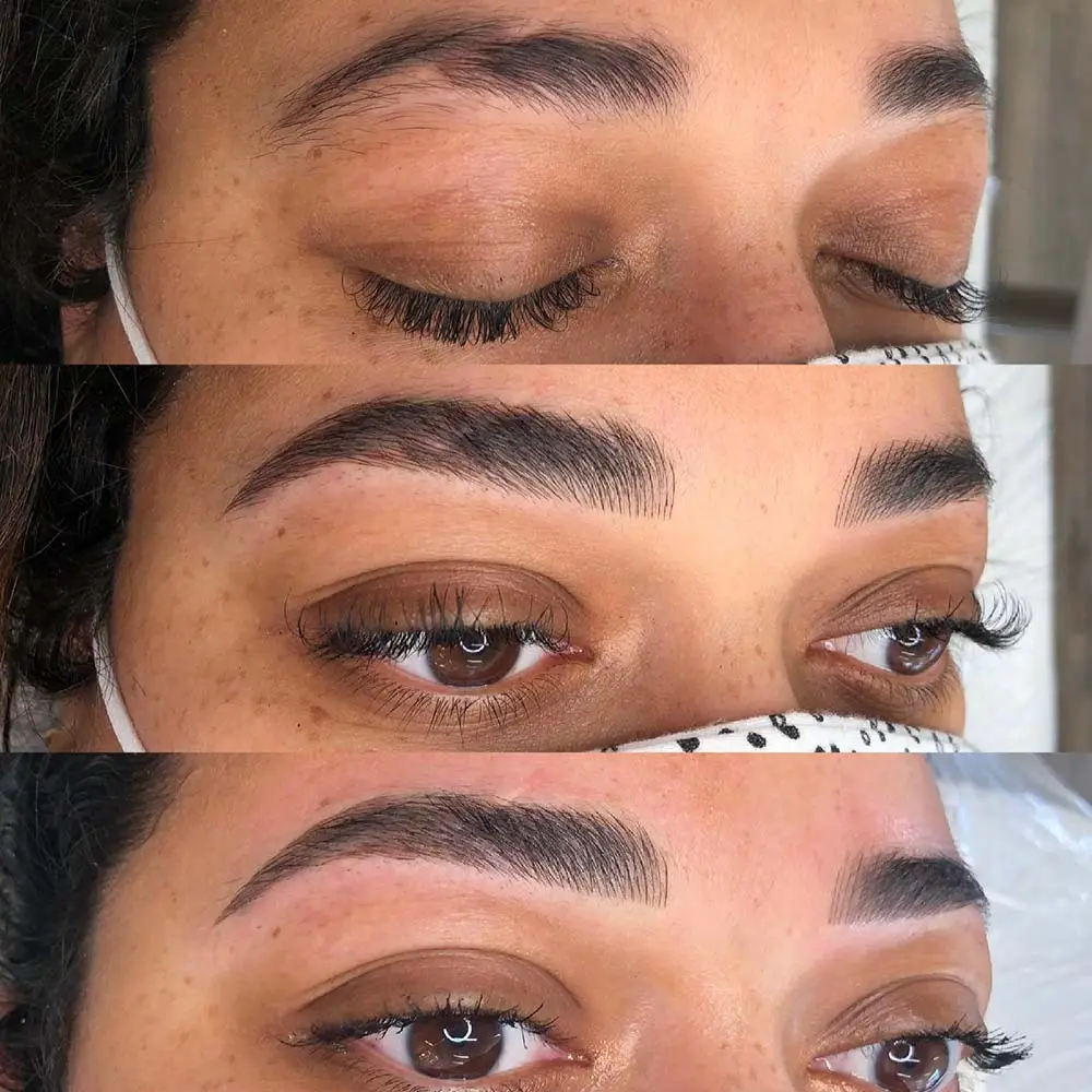 مزایای کاشت ابرو روی زخم