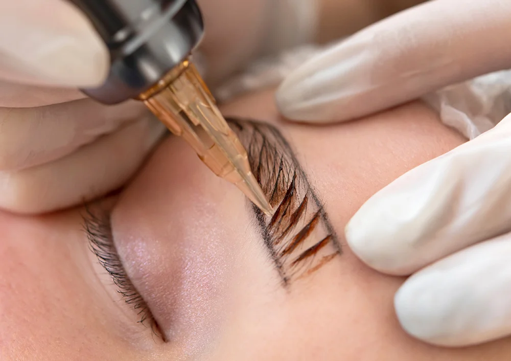 دکتر زیبایی در حال انجام میکروبلیدینگ روی ابروی زن جوان