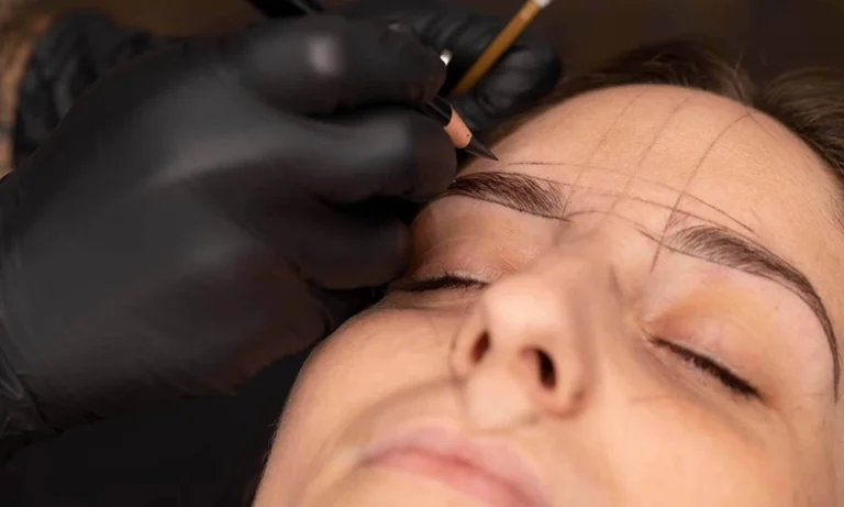 پزشک در حال پیوند ابرو به مراجعه کننده زن به روش اف یو تی - کاشت ابرو FUT