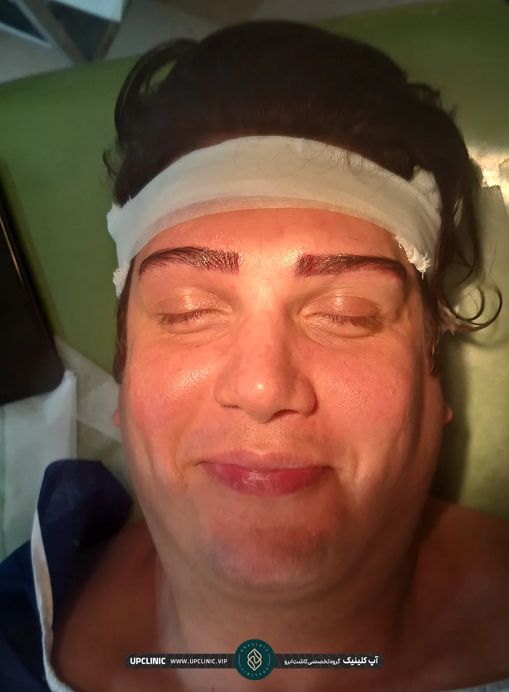 مردی که کاشت ابرو انجام داده و با چشمان بسته لبخند می زند - کاشت ابرو مردانه