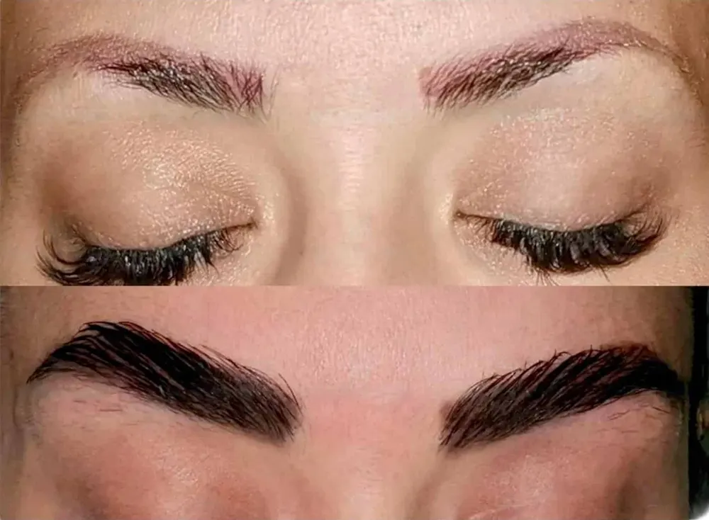 عکس قبل و بعد کاشت ابروی نچرال - کاشت ابرو طبیعی