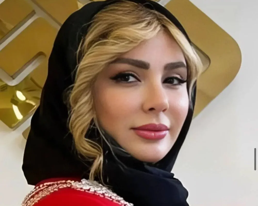 کاشت ابرو نیوشا ضیغمی