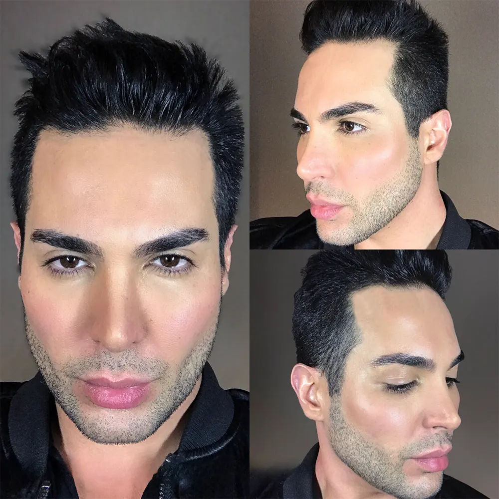 عکس از 3 زاویه مختلف از ابروهای کاشته شده مرد - کاشت ابرو مردانه