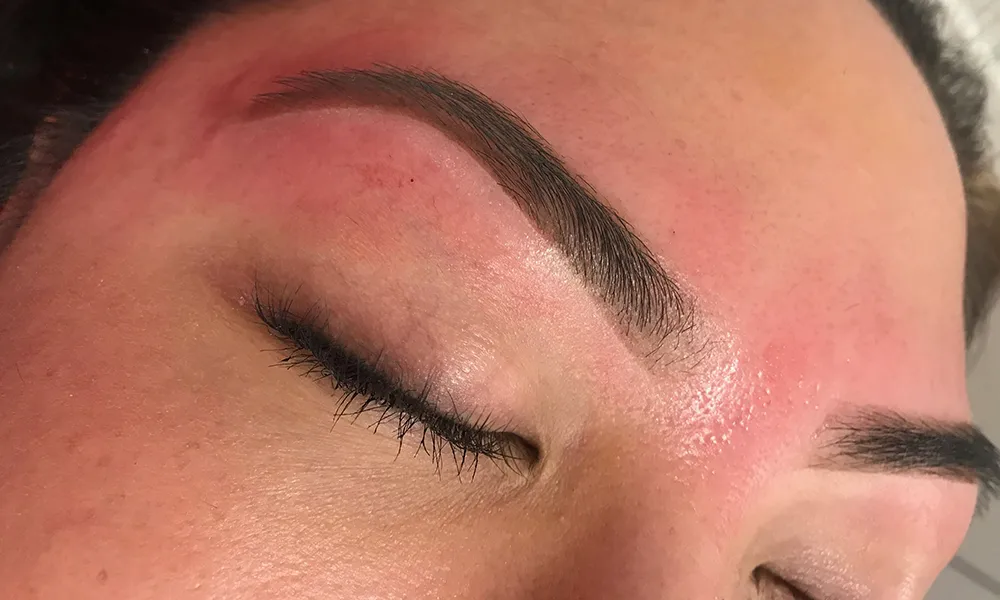 قرمزی پوست بعد از کاشت ابرو - عوارض کاشت ابرو