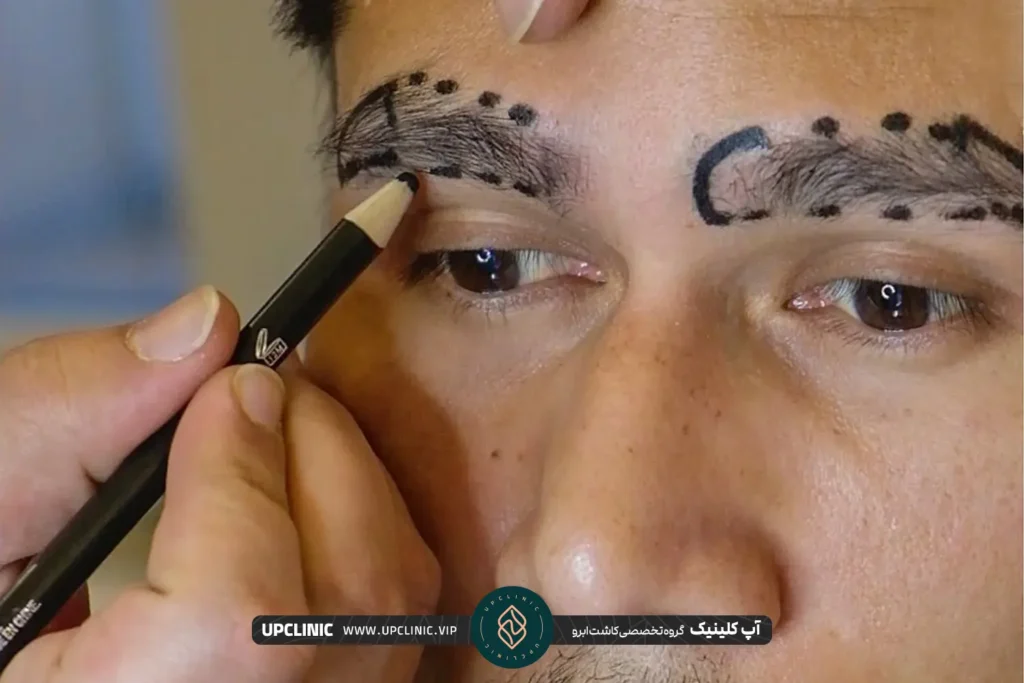 عکس کاشت ابرو روی صورت مرد