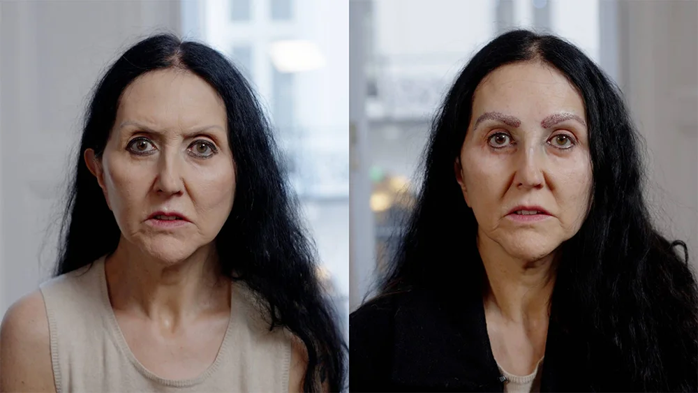 قبل و بعد نتایج کاشت ابرو زنانه