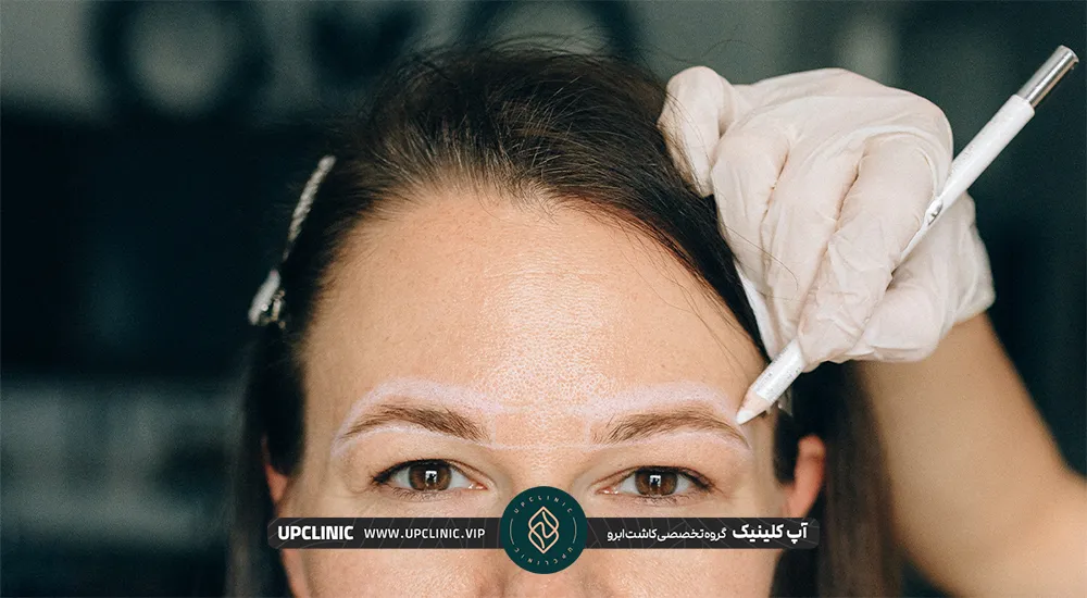 عکس صورت خانم که پزشک با مداد محل کاشت ابروی او را مشخص می کند