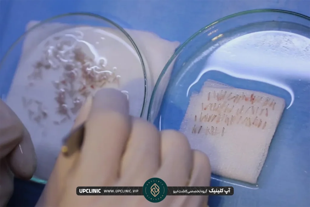 عکس گرافت های مو که برای کاشت ابرو استفاه می شود - کاشت ابرو با موی دیگران