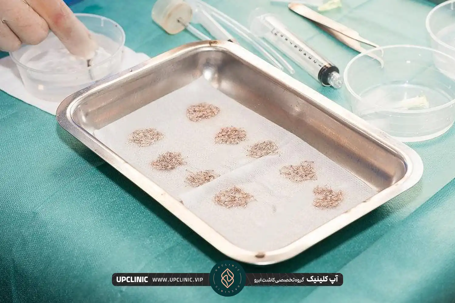 گرافت های مو که قبل از کاشت ابرو داخل ظرف قرار گرفته اند