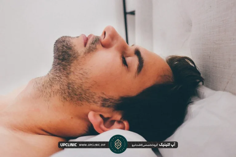 مرد جوانی که بعد از کاشت ابرو روی بالش طبی خوابیده است