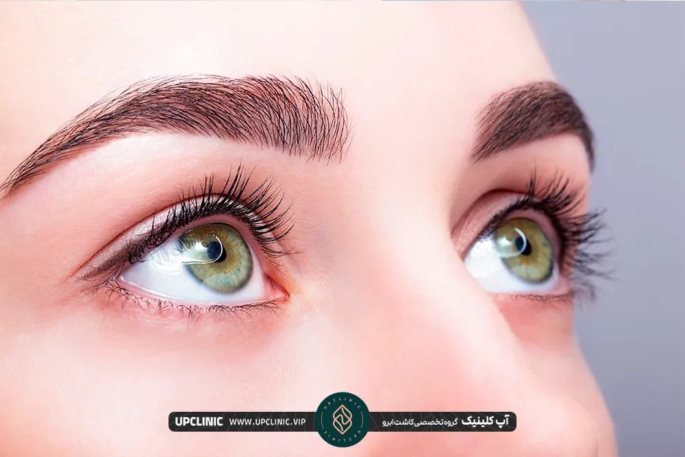 Eyebrow implantation by micrograft method