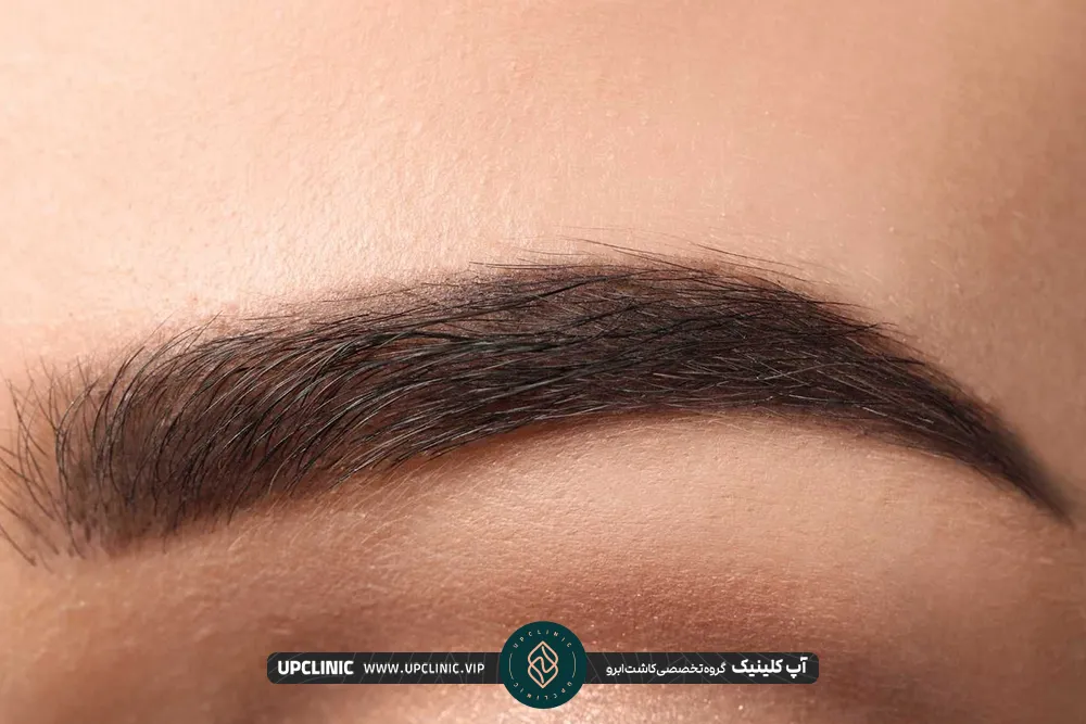 Important preparation points before implanting wide eyebrows