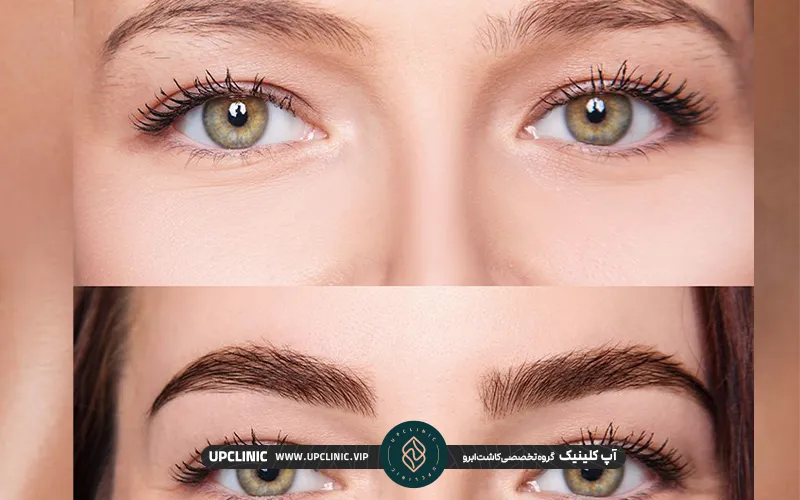 تصویر قبل و بعد از کاشت ابرو یک خانم زیباجو | مراحل رشد ابرو بعد از کاشت