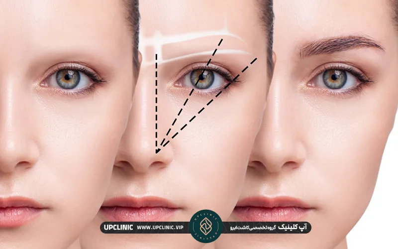 تقویت ابرو بعد از کاشت