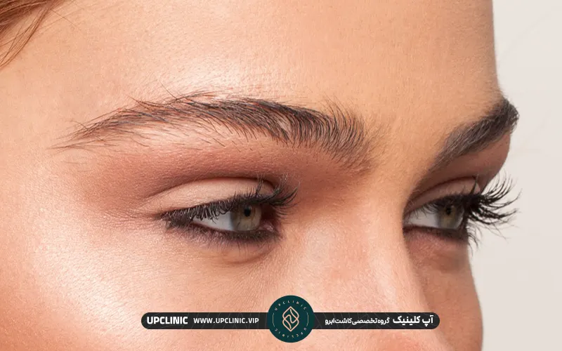 خانمی که مزوتراپی ابرو بعد از کاشت نیاز دارد | مزوتراپی ابرو بعد از کاشت