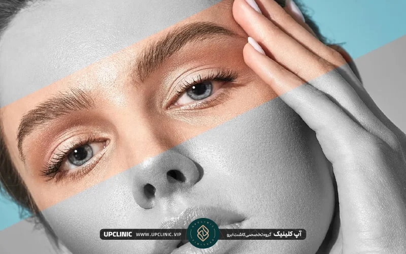 خانمی زیبا که دستهای خود را روی شقیقه اش قرار داده | روش زیبایی ابرو