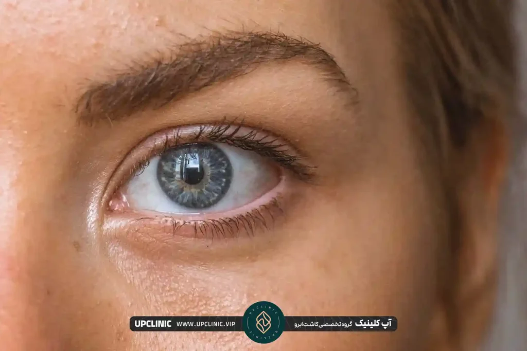 خانمی با پوست برنزه و ابروهایی پرپشت | قیچی زدن ابرو بعد از کاشت