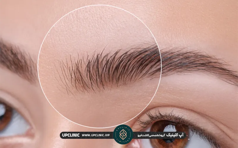 رشد طبیعی موهای کاشته شده ابرو