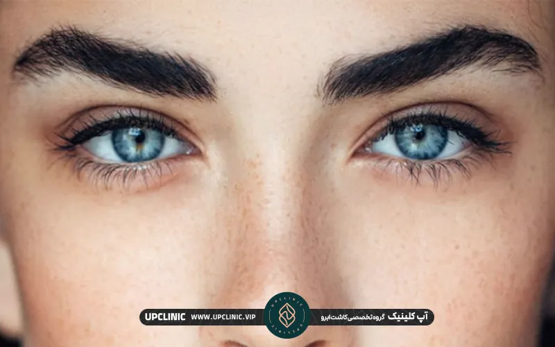 نتیجه ابرو های طبیعی کاشته شده