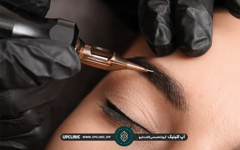 خانمی در حال میکروبلدینگ بعد از کاشت ابرو