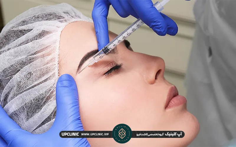 تزریق مزوتراپی ابرو به ابرو یک خانم مراجعه کننده بعد از کاشت