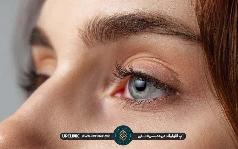 میکروبلدینگ بعد از کاشت ابرو